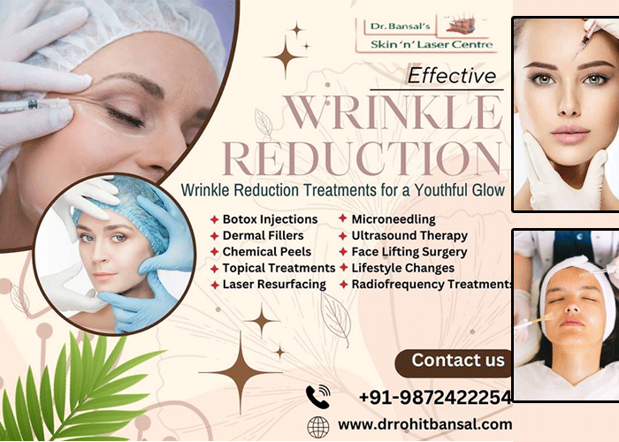 Effective Wrinkle Reduction Treatments for a Youthful Glow