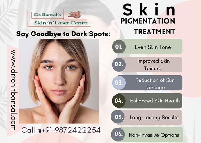 Key Advantages of Skin Pigmentation Treatment